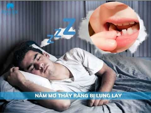 răng lung lay